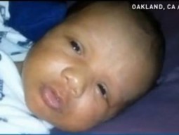 Baby Whose Nose Was Bitten Off By Mother's Boyfriend