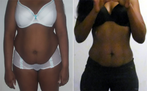 Pure Body Before and After