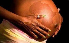 Racism Killing Black Babies