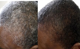African American Gray Hair Reversed