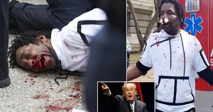 Protestor With Bloody Nose at Donald Trump Rally