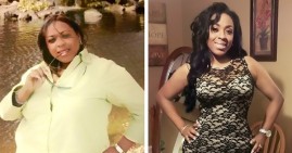 Chandra Harris, before and after