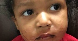 Kylen Holliman, 3-year old survivor and hero from a car accident