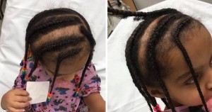 3-year-old girl got her braid ripped