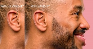 Black man wearing Vanish hearing aid