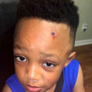 Amonn Jackson, student whose teacher painted a fake bullet wound on his forehead