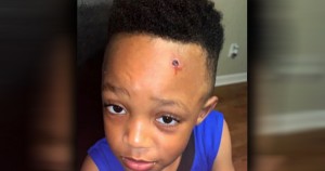 Amonn Jackson, student whose teacher painted a fake bullet wound on his forehead