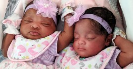 Healthy twin babies born to mom with COVID-19