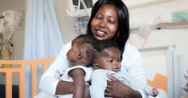 Ervina and Prefina, African conjoined twin girls