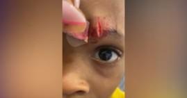 Miami Gardens Boy Injured