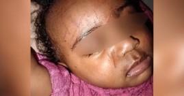 Kendra Small's daughter suffered scratches