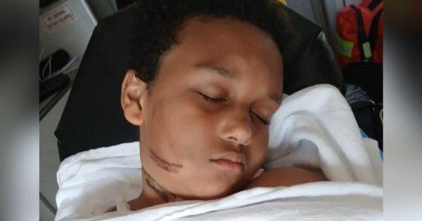 9-Year-Old Black Boy Suffers Severe Burns After Tablet Charger Sparks Fire on His Necklace