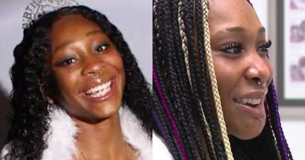 Black Teen Shot in the Face Gets Her Jaw Reconstructed with AI and 3D Printing