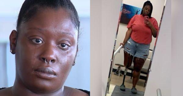 Black Woman Wins M After Losing Her Leg Because of Delayed Hospital Treatment
