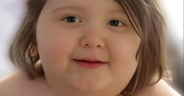 7-year-old boy weighing 255 pounds