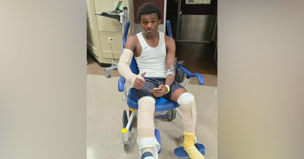 Black Teen Saves His Family from House Fire, But Suffers Severe Third-Degree Burns