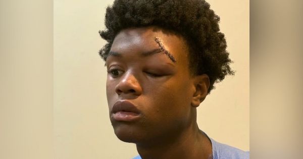 Black Teen Knocked Unconscious in Alleged Attack at a Mental Health Facility