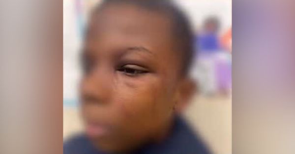 Black Mom Blames Chicago Public Schools, Says Teacher Assaulted Her 12-Year-Old Son