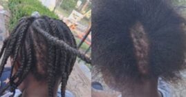 Stacy McGilberry's daughter's hair