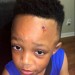Amonn Jackson, student whose teacher painted a fake bullet wound on his forehead