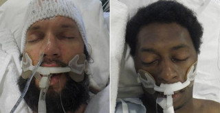 Unidentified Black patients